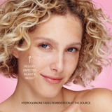 Superfade Face Treatment Cream 20mL