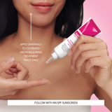 Superfade Depigma Accelerator Serum