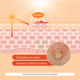 John Plunkett's - Sunspot Cream Out of stock due in end August