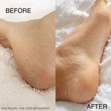 NS8 All-In-One Heel Balm