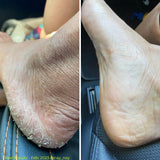 NS8 All-In-One Heel Balm