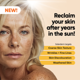 Solarderm Face & Body Recovery Cream
