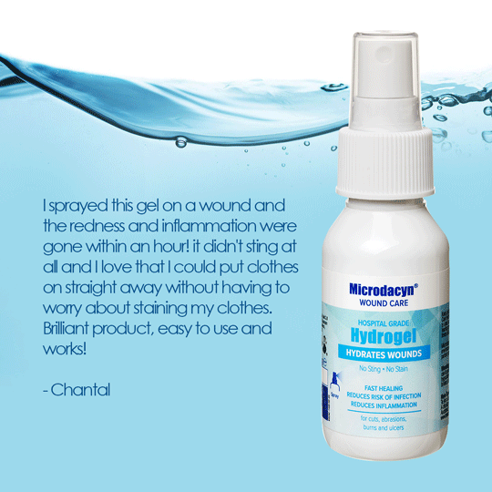 Epycin Wound Care Hydrogel | No sting, No stain, antiseptic – Plunkett ...